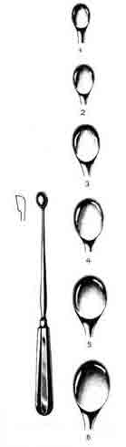 610-529FSI-Simon Cup Curette, Size 1