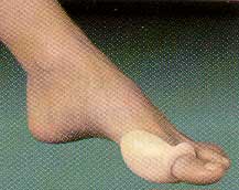 MMSIL104-mse-Silopad Gel Bunion - Small
