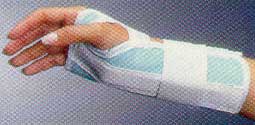 Wrist and Forearm Splint