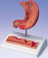 3 Part Digestive System Anatomical Model