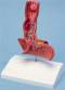 Diseases of the Esophagus Anatomical Model