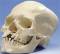 Skull w/ Cleft Jaw & Plate
