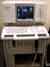 CYPRESS C/V (Ultrasound Machine)